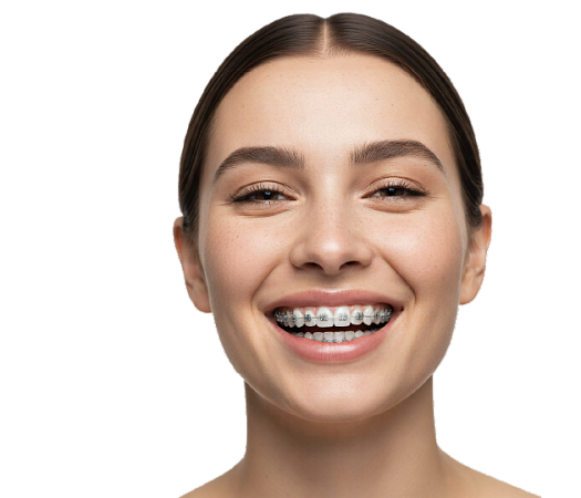 Брекеты под ключ!