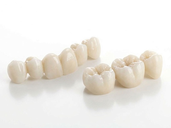 Мини-импланты